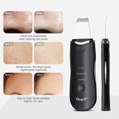 Derma Skin Scrubber Pen